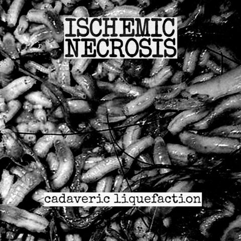 Ischemic Necrosis – Cadaveric Liquefaction