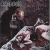 Cyanosis  - Perpetuation Of Eradication