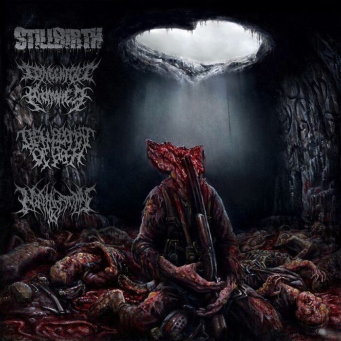 Stillbirth