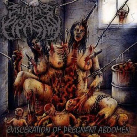Suicide Of Disaster – Evisceration Of Pregnant Abdomen