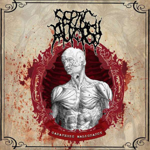 Septic Autopsy ‎– Cadaveric Malignancy