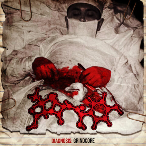 Amoclen ‎– Diagnosis: Grindcore